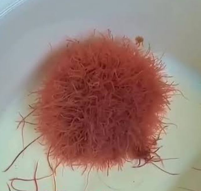Gusanos de sangre